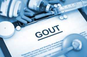 Does Sleep Apnea Affect Gout?