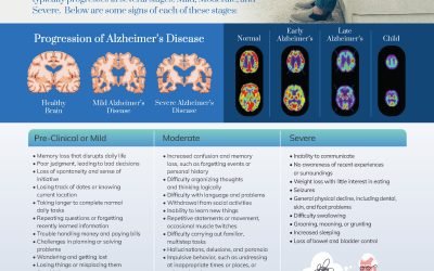 Alzheimer’s Disease Stages & Symptoms